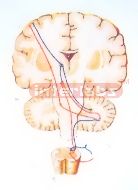 HANGING EXTRAPYRAMIDAL SYSTEM MODEL (CORTEX -PONS-CEREBELLUM SYSTEM)